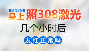 身上毛发都白了是白癜风吗?
