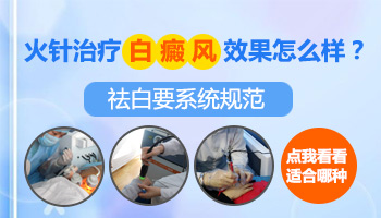 脸部白癜风怎么治疗好？专业解答与指导