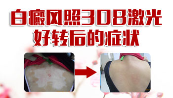 女性白癜风患者能否圆怀孕生子之梦?