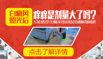 额头白癜风治疗见效快的方法解析