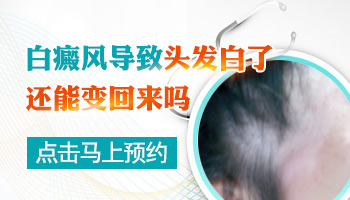 儿童白癜风治疗通常如何进行？”