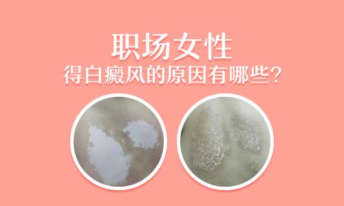 小孩的白癜风照308多久能恢复?
