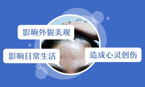 孩子肚子上出现的白斑,类似白癜风,半年无变化是怎么回事?”