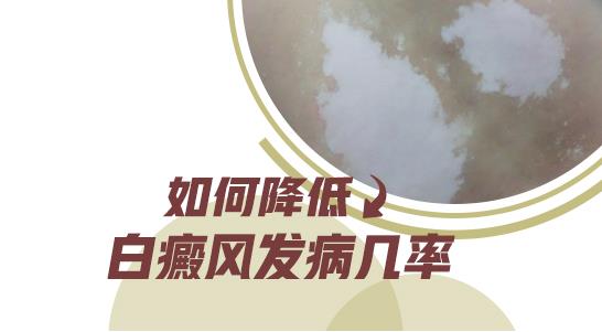 哪些方法对治疗女性白癜风比较好