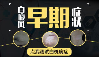 小孩长白癜风照308激光后复发多不多?”