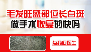 宝宝得了白癜风怎么治疗好？专业解析与指南”