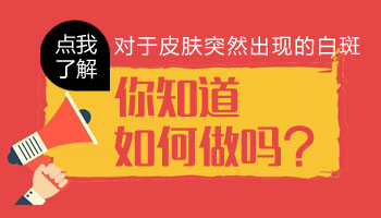 儿童肩膀有白点照UVB能治得好吗