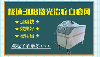 儿童鼻子长白癜风照激光一次需要多久