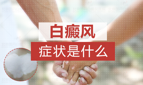 儿童腿上有片白怎么治疗有康复案例吗