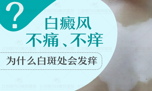 儿童眼处长白癜风做308激光照多长时间合适
