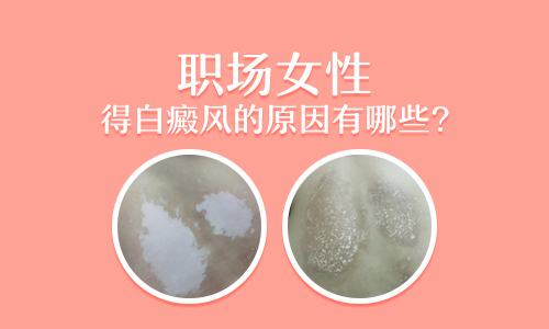 儿童额头有白块照UVB能治得好吗