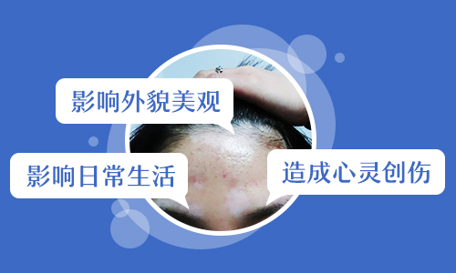 儿童眼处有白块进口308激光怎么治疗