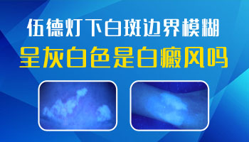 儿童肩膀巴掌大白斑在变大该怎么办