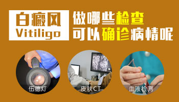 儿童腰部有白点做308激光照多长时间合适