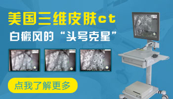 儿童眼处巴掌大白斑进口308激光怎么治疗