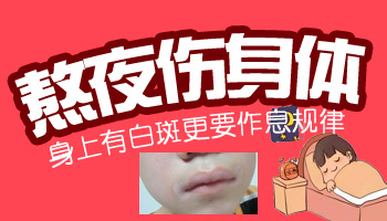 儿童腿上有白点怎么治疗科学