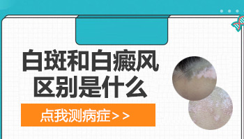 儿童眼处有白斑怎么用药恢复的快