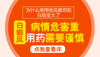 儿童肩膀有片白照UVB能治得好吗