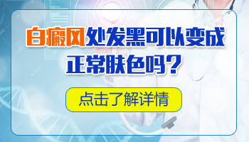 儿童腰部巴掌大白斑照308激光发痒怎么回事