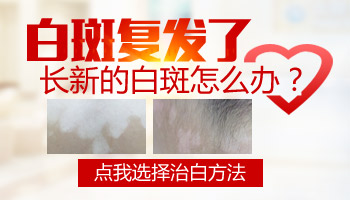 儿童肩膀有白块照完308红多久是正常的