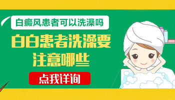 儿童腿上长白癜风抹他克莫司多久能好