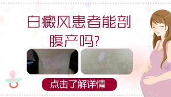 儿童面部有白点中西医结合治疗怎么样