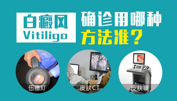 儿童胸部有白点哪种疗法适合