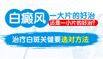 儿童腹部有白斑只照308激光能控制住吗