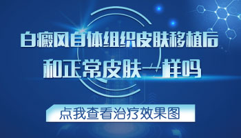 儿童下巴有白斑一直扩散用什么方法控制