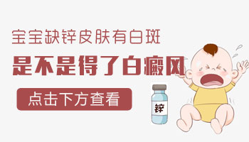 儿童头部有白斑怎么回事