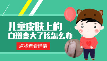 儿童胸部巴掌大白斑只照uvb光能控制住吗