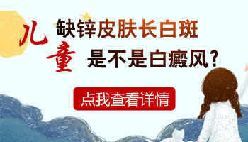 儿童手部有白块照308激光能治好吗