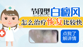 儿童额头巴掌大白斑怎么回事