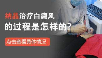 儿童面部有片白照308激光多长时间有好转