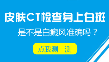 儿童面部有片白照308激光多长时间有好转