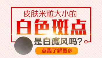 儿童腿上有白点照308激光3次不见效怎么办
