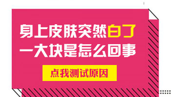 儿童肩膀有片白照UVB能治得好吗