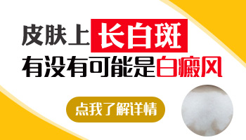 儿童腹部长白癜风怎么用药恢复的快