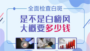 儿童眼处有白斑进口308激光怎么治疗
