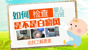 儿童下巴有片白只照308激光能控制住吗