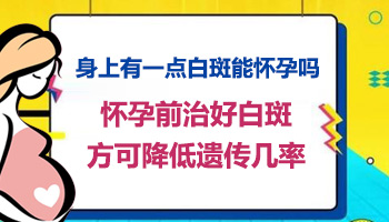 儿童面部长白癜风啥情况 怎么治疗