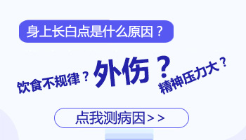 儿童肩膀有白点照308激光能治好吗