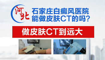 儿童腹部有白块照激光一次需要多久