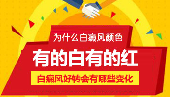 儿童头部有白斑哪种疗法适合