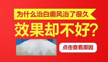 儿童面部有片白照UVB能治得好吗