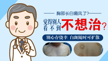 儿童鼻子长白癜风照308激光多长时间有好转