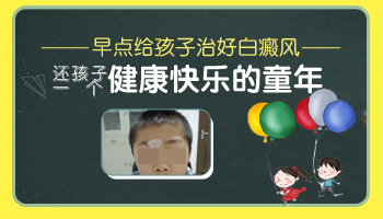 儿童腹部有白斑抹药膏效果怎么样