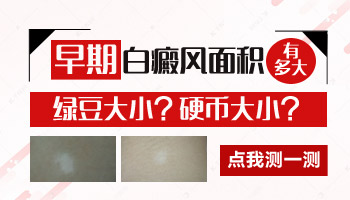 儿童后背巴掌大白斑照308好还是uvb效果好