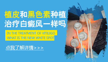 儿童下巴有白块照308激光变黑还继续照吗