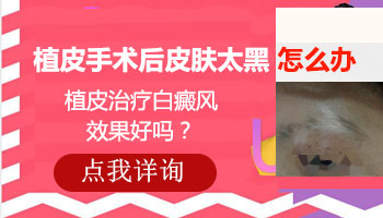 儿童脚部有白块怎么治疗科学